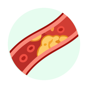 Cholesterol